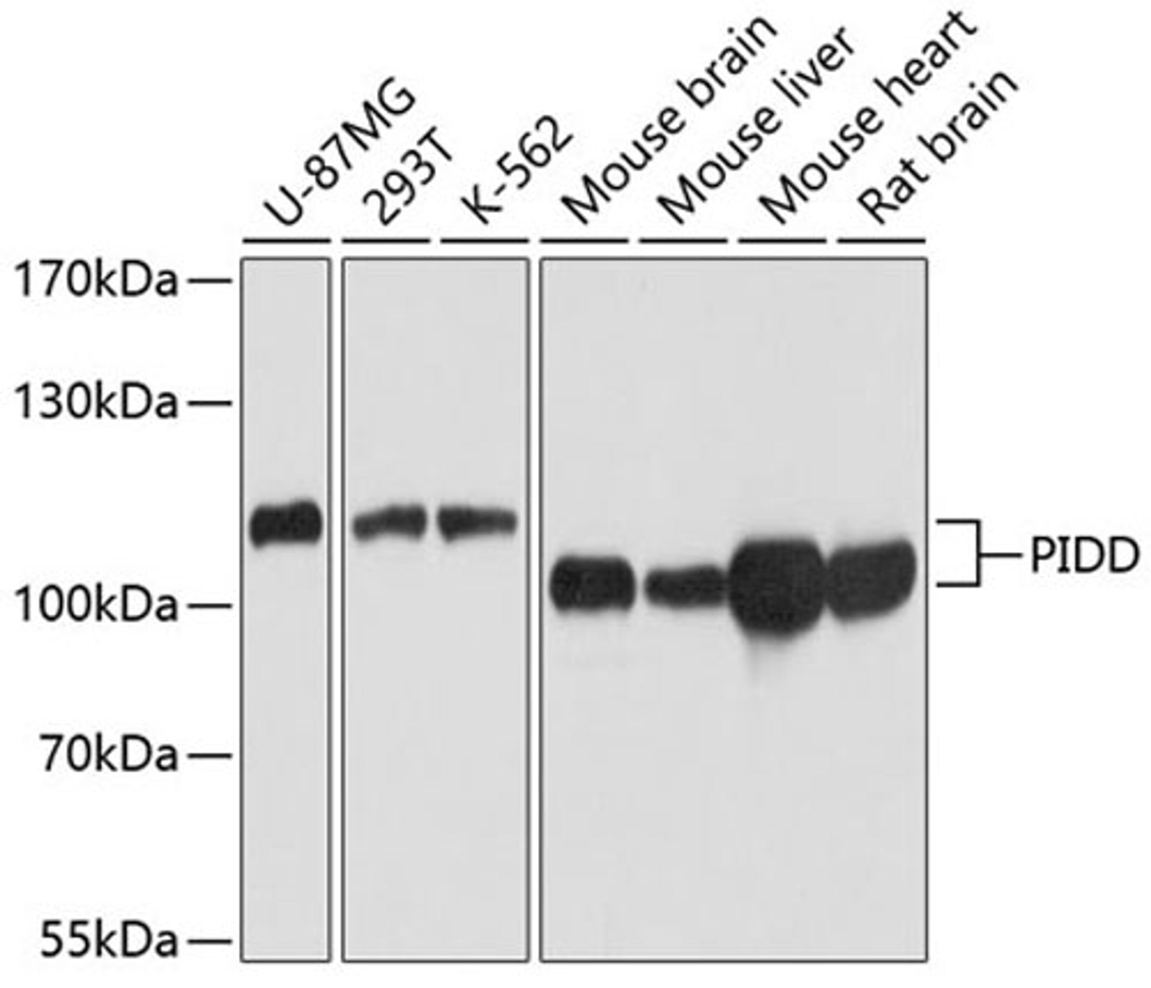 Western blot - PIDD antibody (A4831)