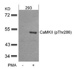 Western blot analysis of lysed extracts from 293 cells untreated or treated with PMA using CaMKII (Phospho-Thr286).