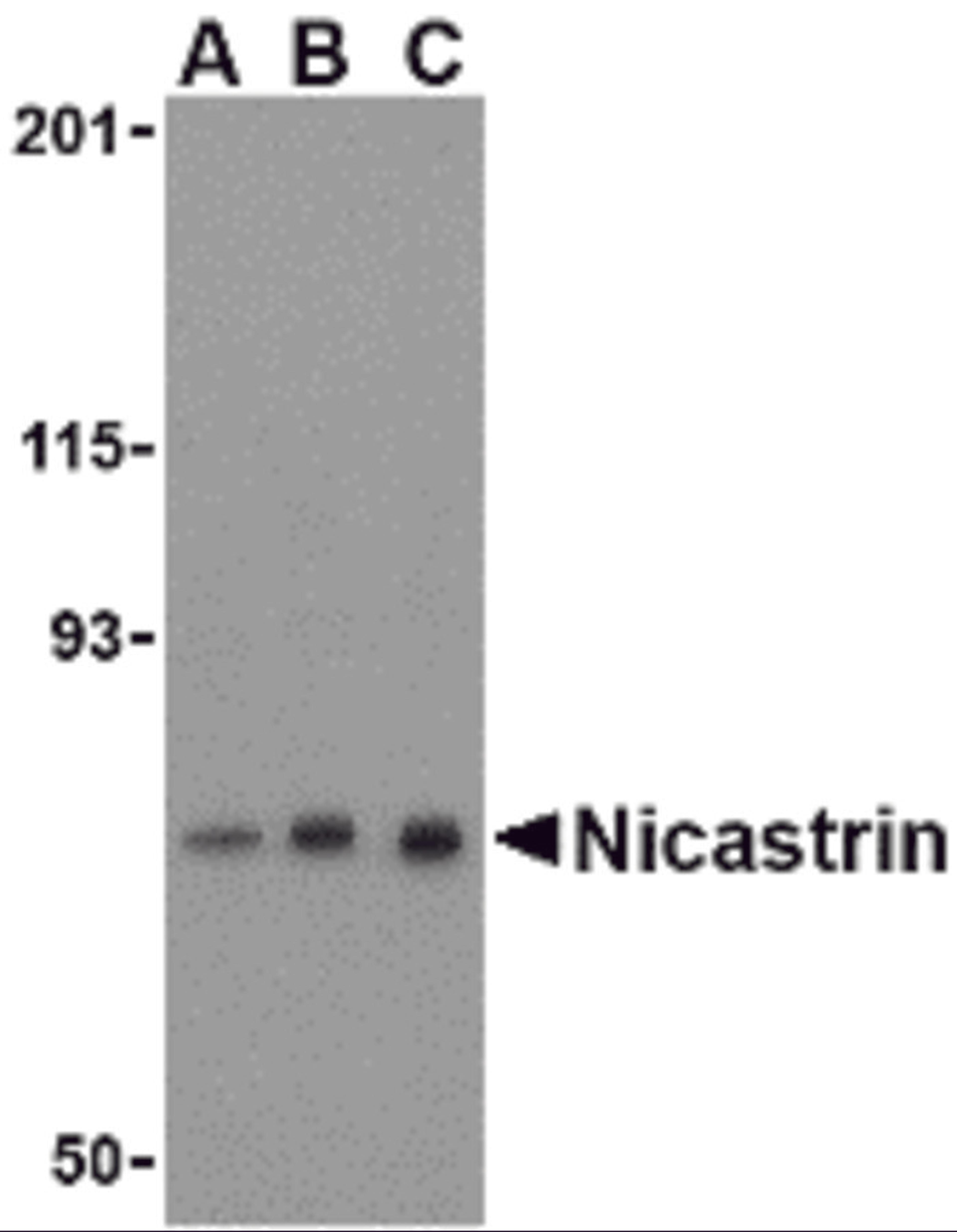 Western blot analysis of Nicastrin in mouse brain tissue lysate with Nicastrin antibody at (A) 0.5, (B) 1, and (C) 2 &#956;g/mL. 