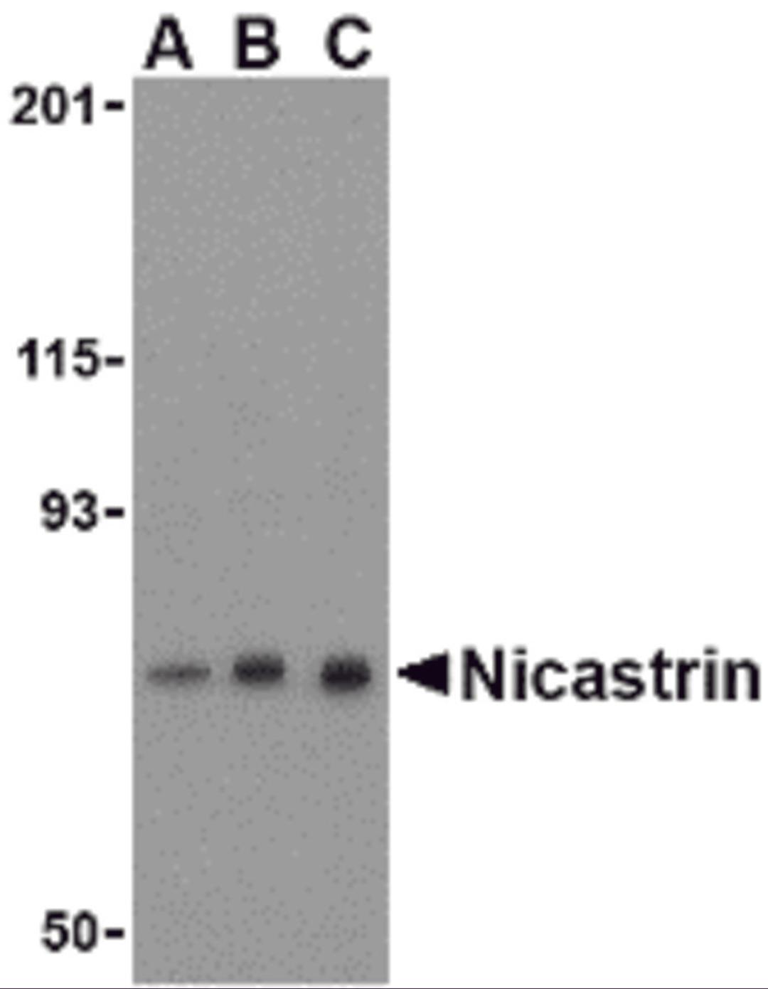 Western blot analysis of Nicastrin in mouse brain tissue lysate with Nicastrin antibody at (A) 0.5, (B) 1, and (C) 2 μg/mL.