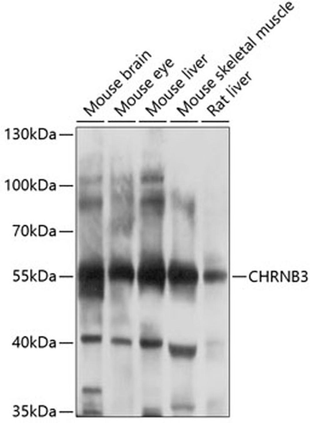 Western blot - CHRNB3 antibody (A10108)