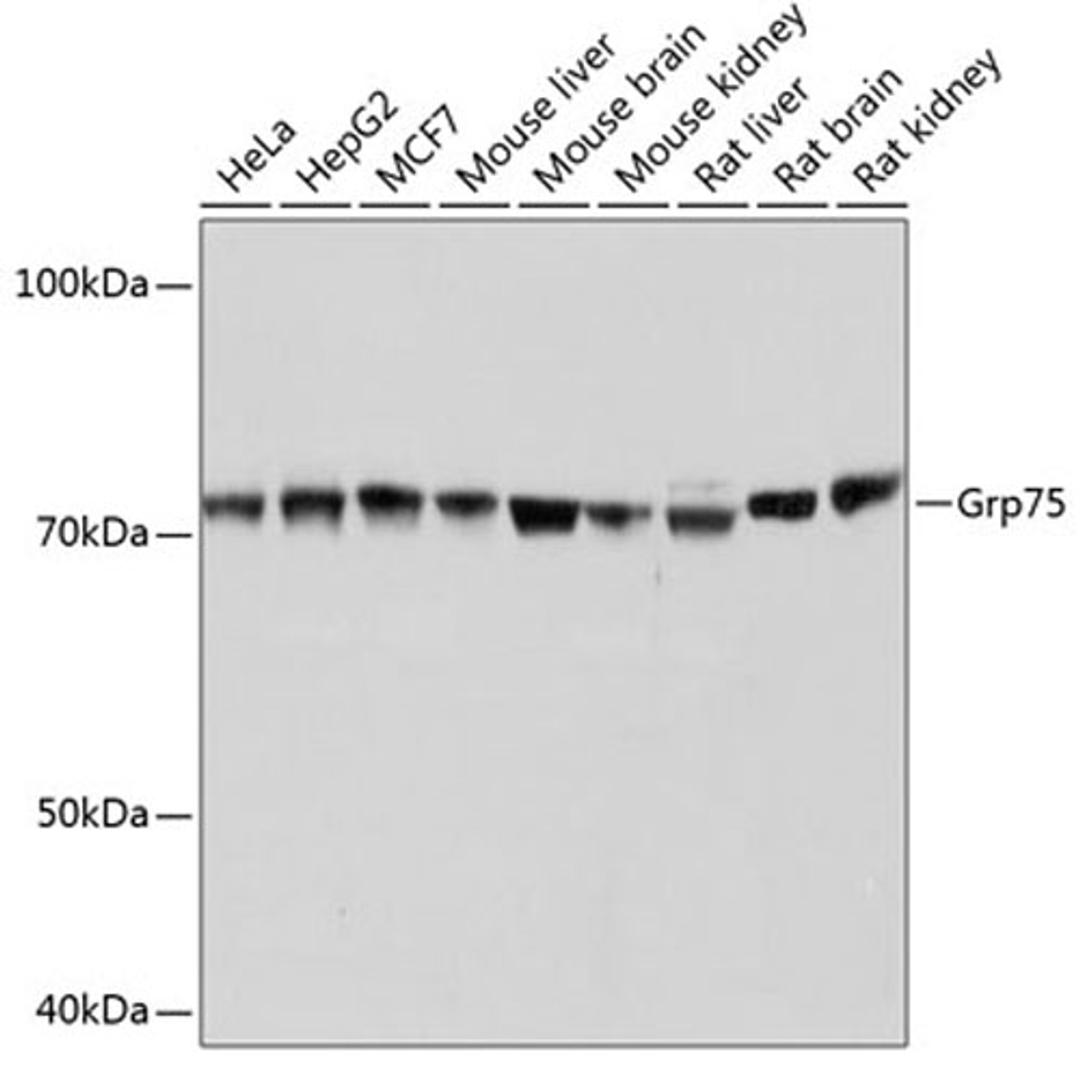 Western blot - Grp75 Rabbit mAb (A11256)