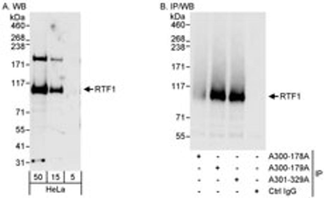 Detection of human RTF1 by western blot and immunoprecipitation.