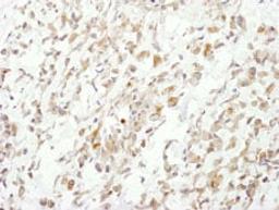 Detection of human Cul1 by immunohistochemistry.