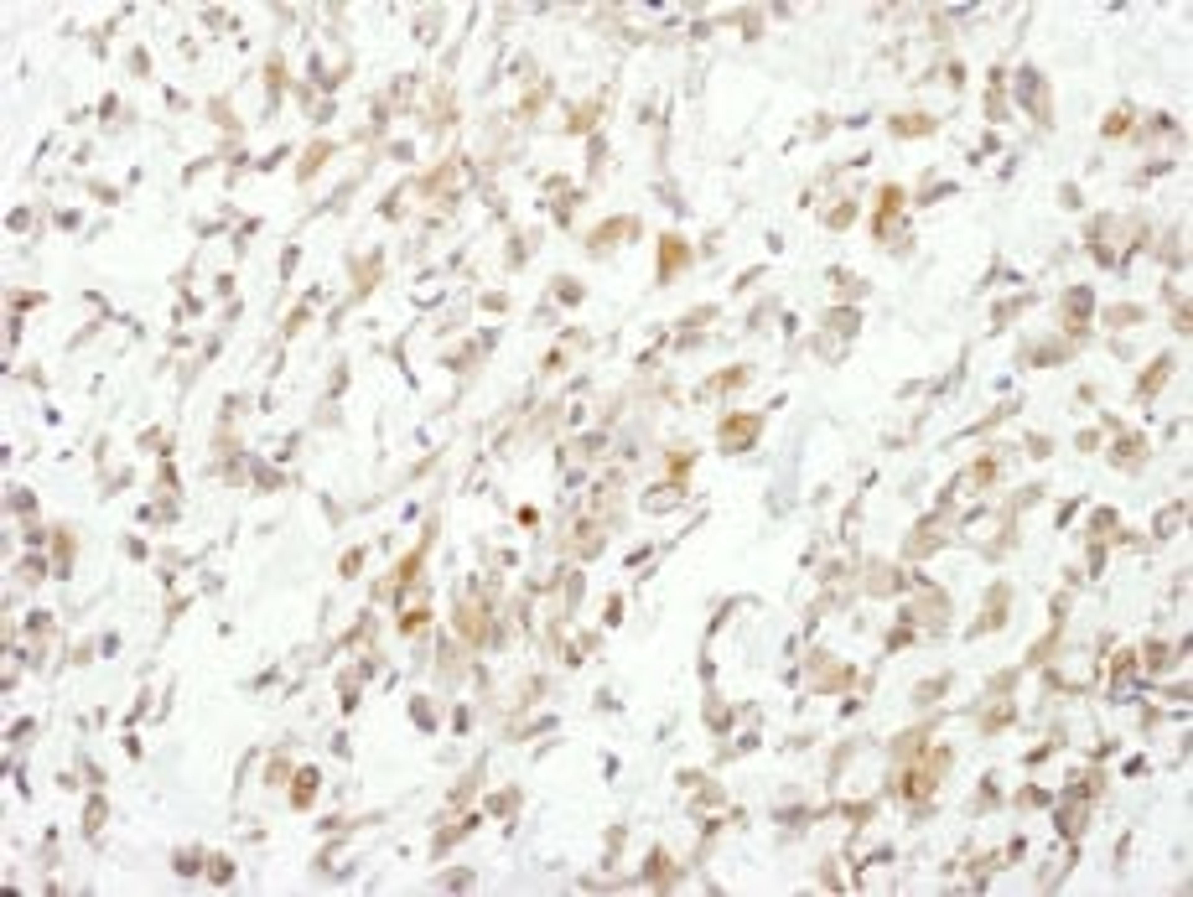 Detection of human Cul1 by immunohistochemistry.