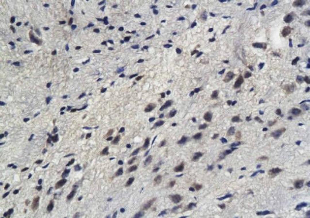 Immunohistochemical analysis of paraffin-embedded mouse brain tissue using Sphingomyelin Synthase 1 antibody.