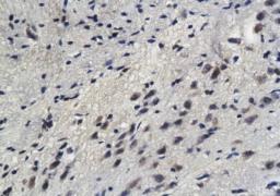 Immunohistochemical analysis of paraffin-embedded mouse brain tissue using Sphingomyelin Synthase 1 antibody.