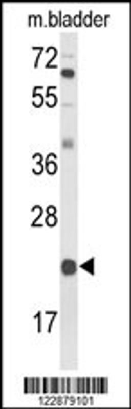 Western blot analysis of DGCR6 Antibody in mouse bladder tissue lysates (35ug/lane)