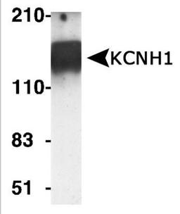 Western Blot: KCNH1 Antibody [NBP1-42816] - Analysis of KCNH1 expression in rat brain lysate.