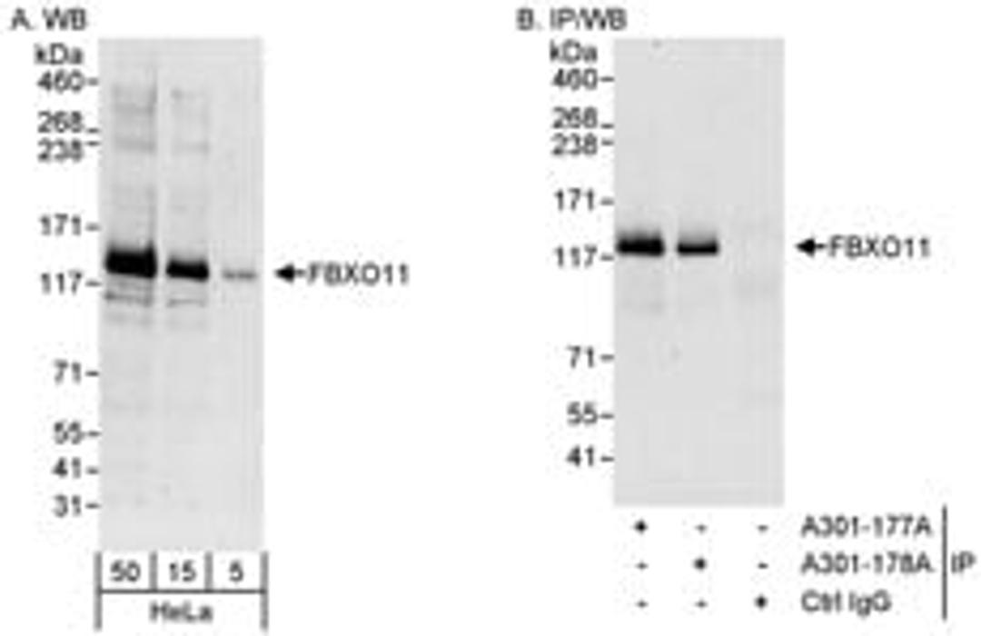 Detection of human FBXO11 by western blot and immunoprecipitation.