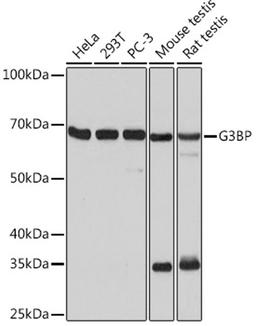 Western blot - G3BP Rabbit mAb (A3968)