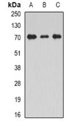 Western blot analysis of THP1 (Lane1), Jurkat (Lane2), mouse testis (Lane3) whole cell lysates using STXBP2 antibody