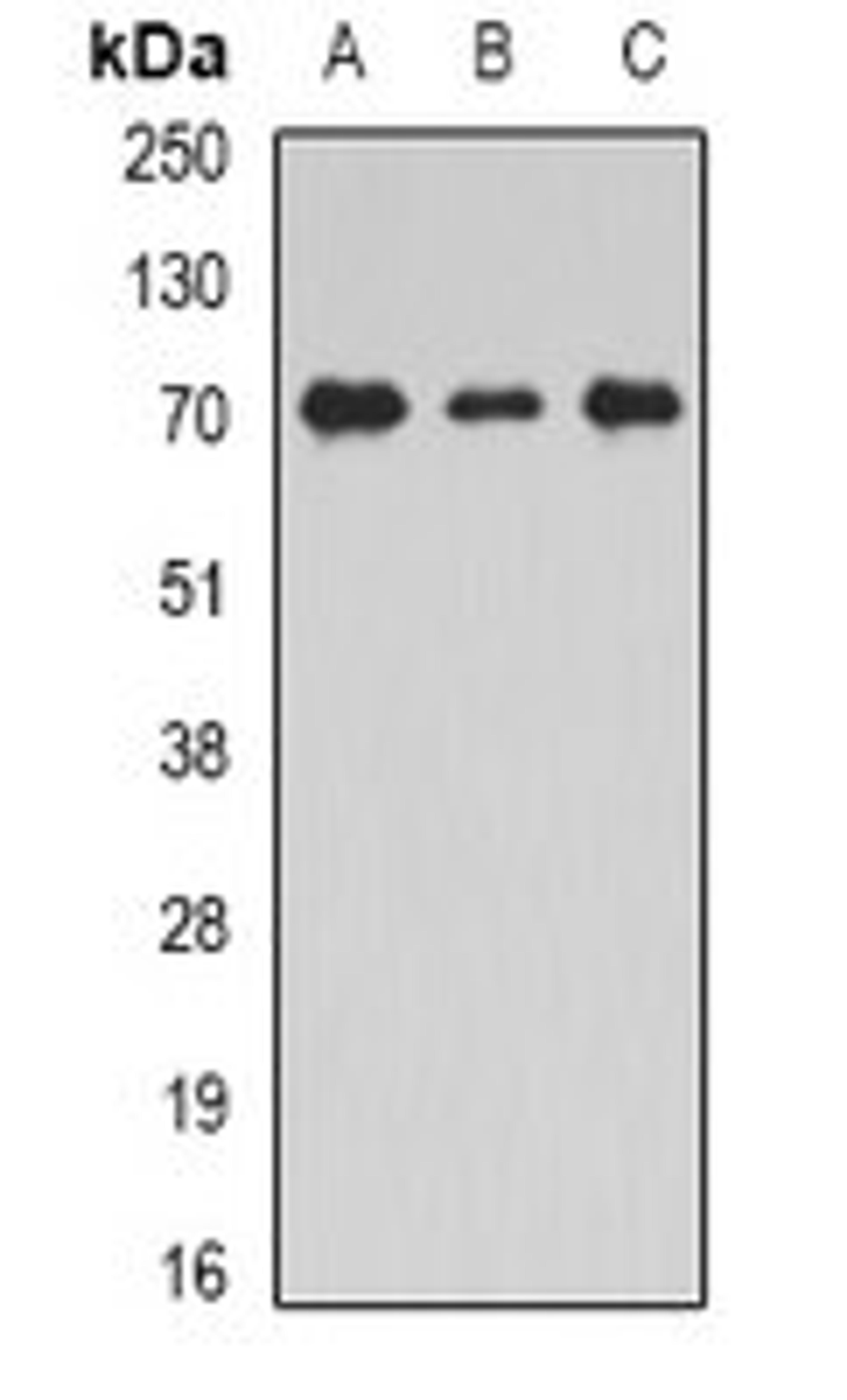 Western blot analysis of THP1 (Lane1), Jurkat (Lane2), mouse testis (Lane3) whole cell lysates using STXBP2 antibody