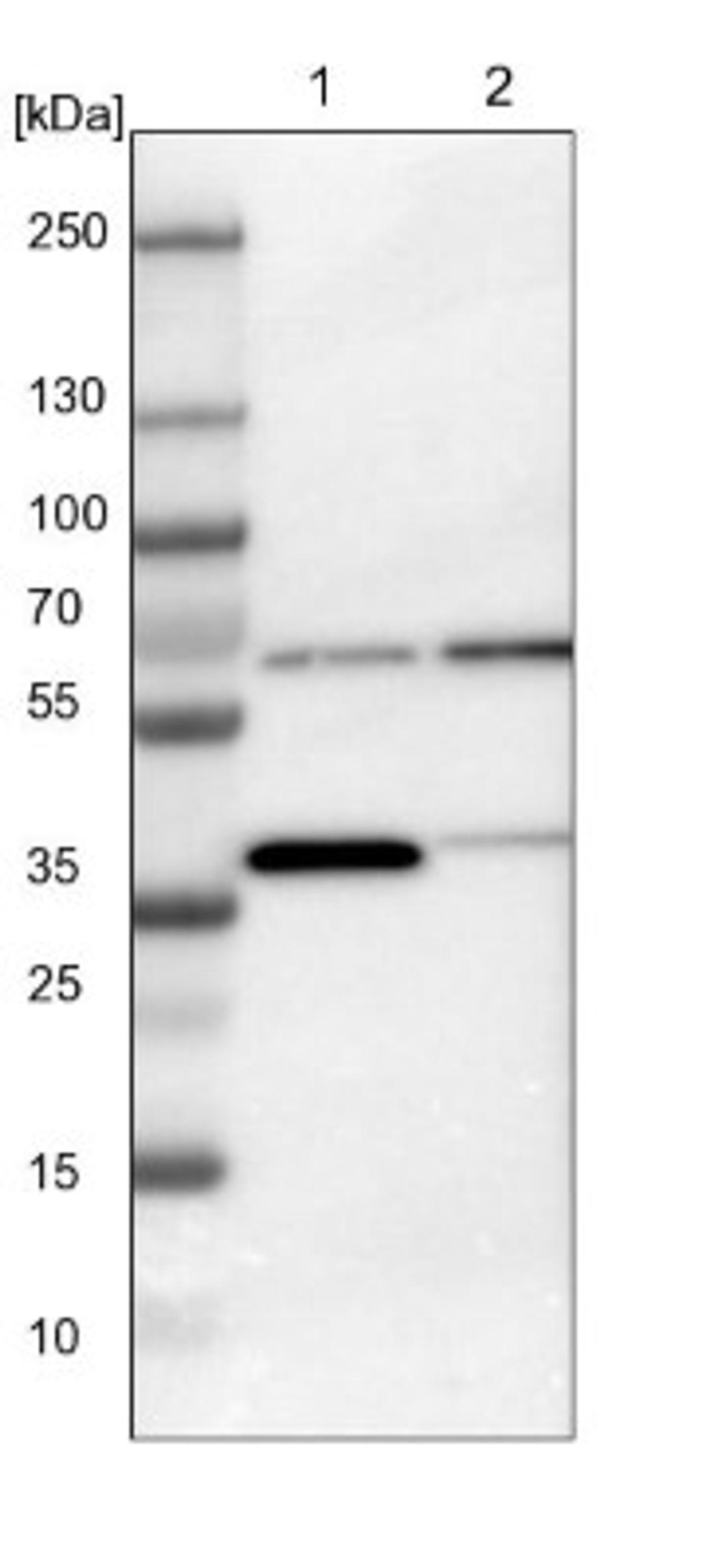 Western Blot: CCT3 Antibody [NBP1-86562] - Lane 1: NIH-3T3 cell lysate (Mouse embryonic fibroblast cells)<br/>Lane 2: NBT-II cell lysate (Rat Wistar bladder tumour cells)