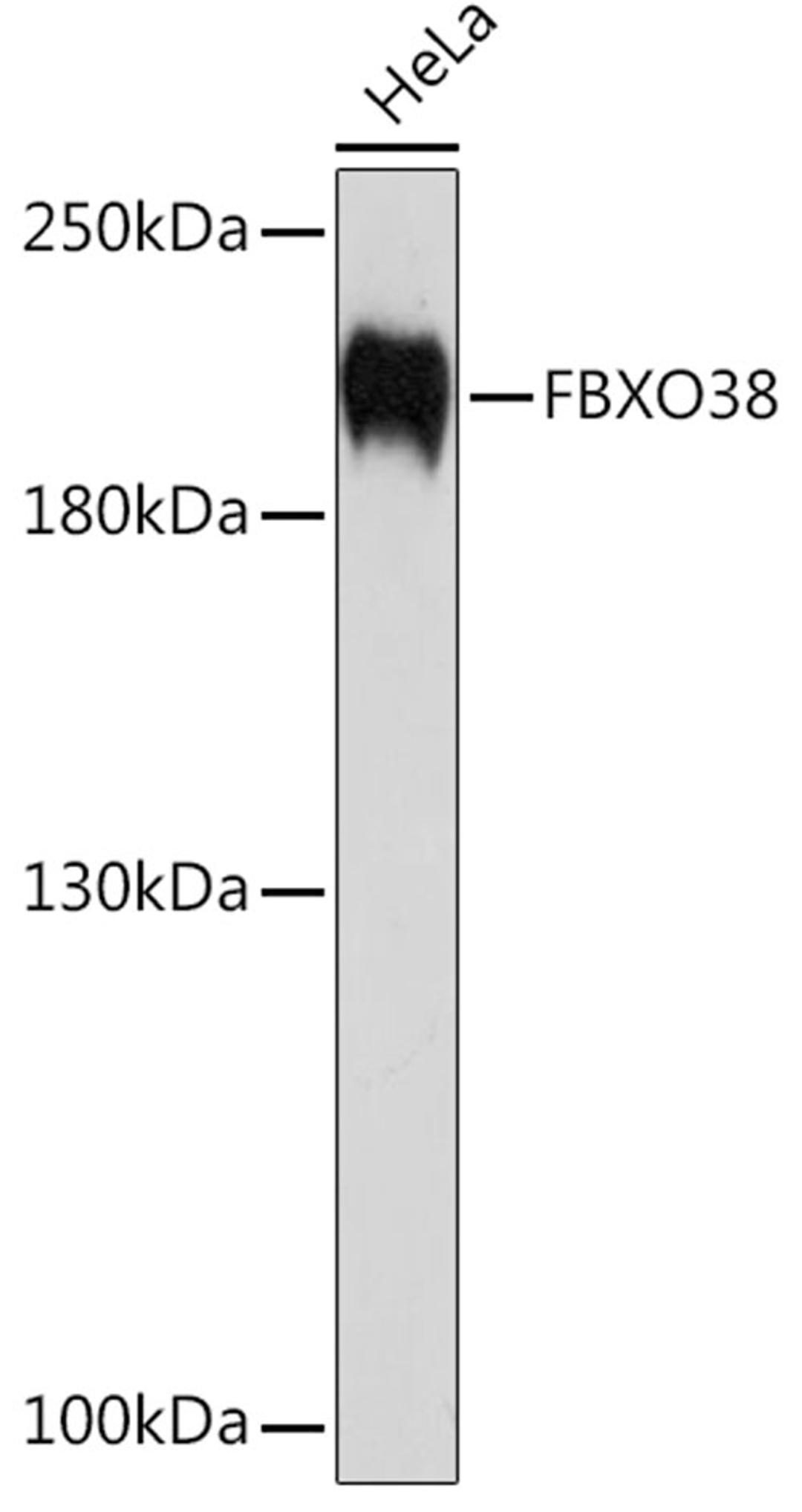 Western blot - FBXO38 Rabbit pAb (A10328)