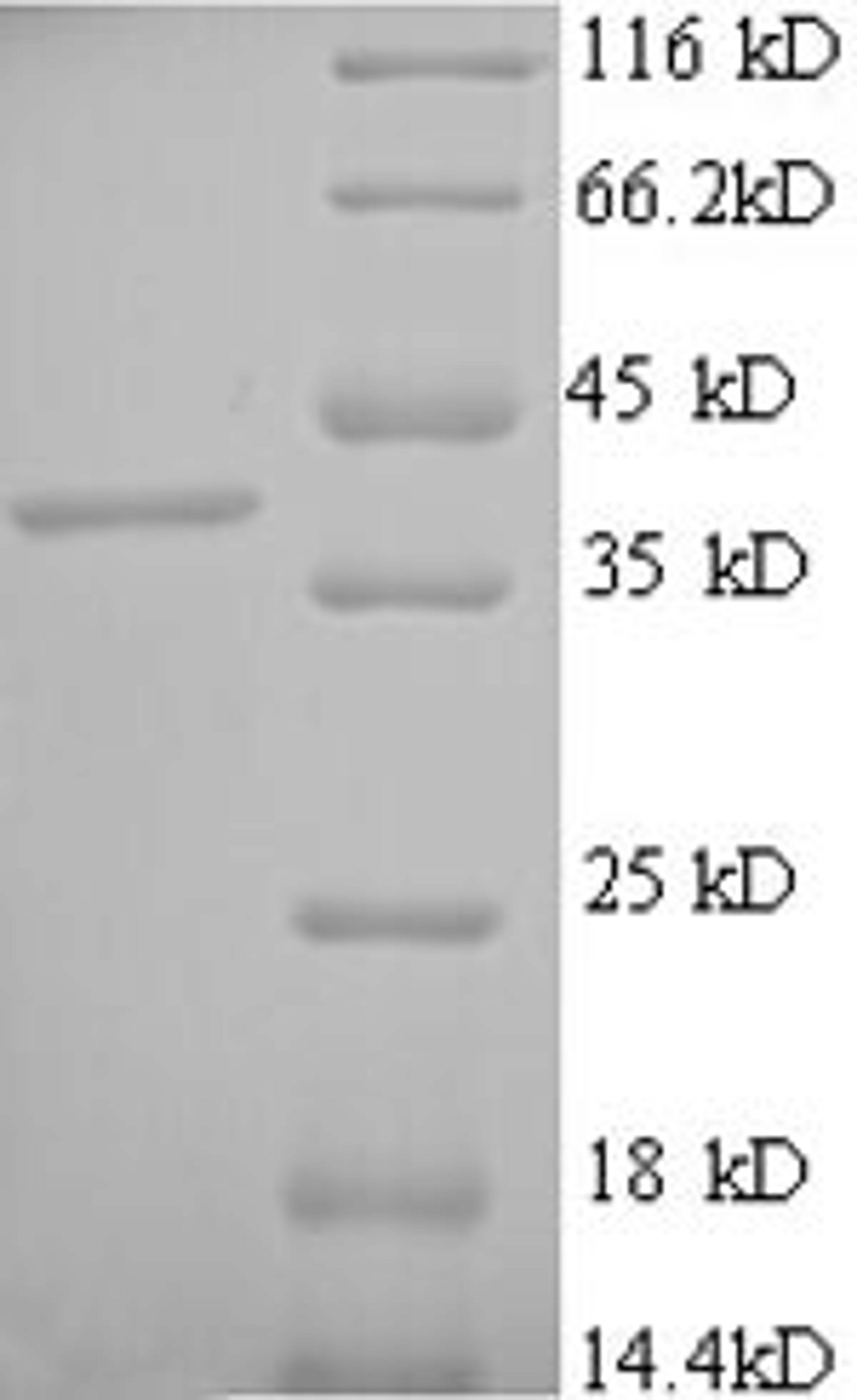 (Tris-Glycine gel) Discontinuous SDS-PAGE (reduced) with 5% enrichment gel and 15% separation gel.