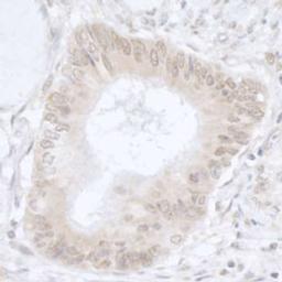 Detection of human USP36/DUB1 by immunohistochemistry.