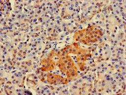 Immunohistochemistry of paraffin-embedded human pancreatic tissue using CSB-PA622511LA01HU at dilution of 1:100