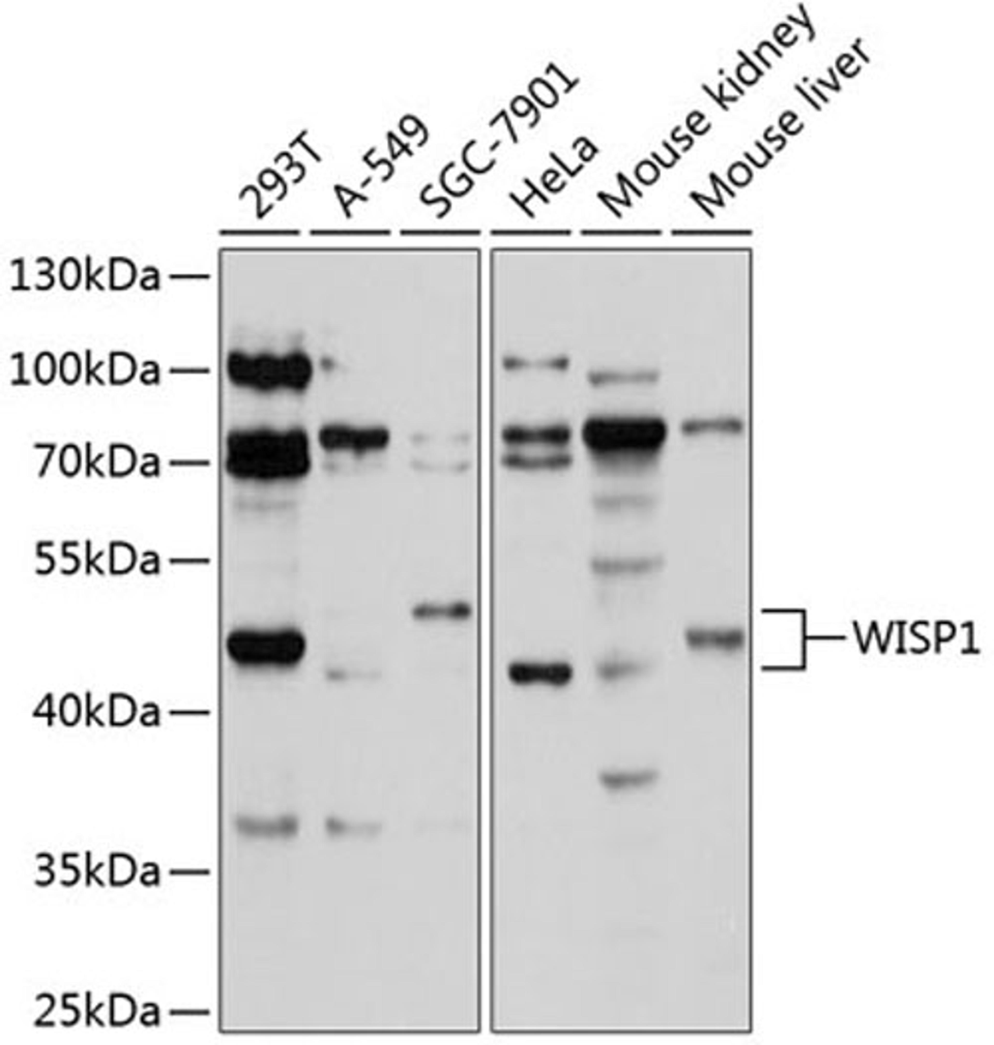 Western blot - WISP1 antibody (A3346)