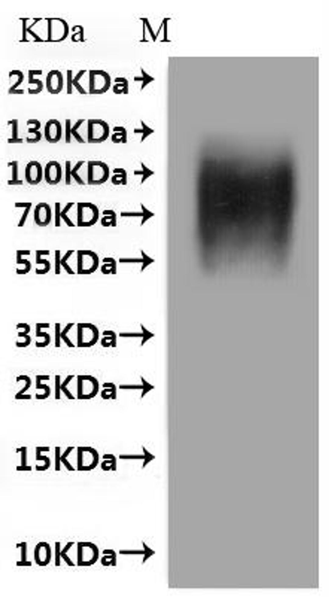 CSB-MP001392HU(M) is detected by Mouse anti-6*His monoclonal antibody.