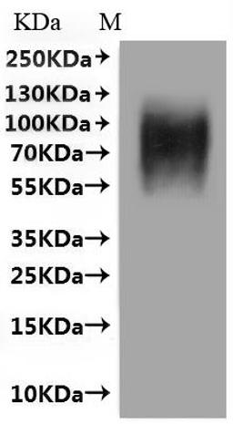 CSB-MP001392HU(M) is detected by Mouse anti-6*His monoclonal antibody.