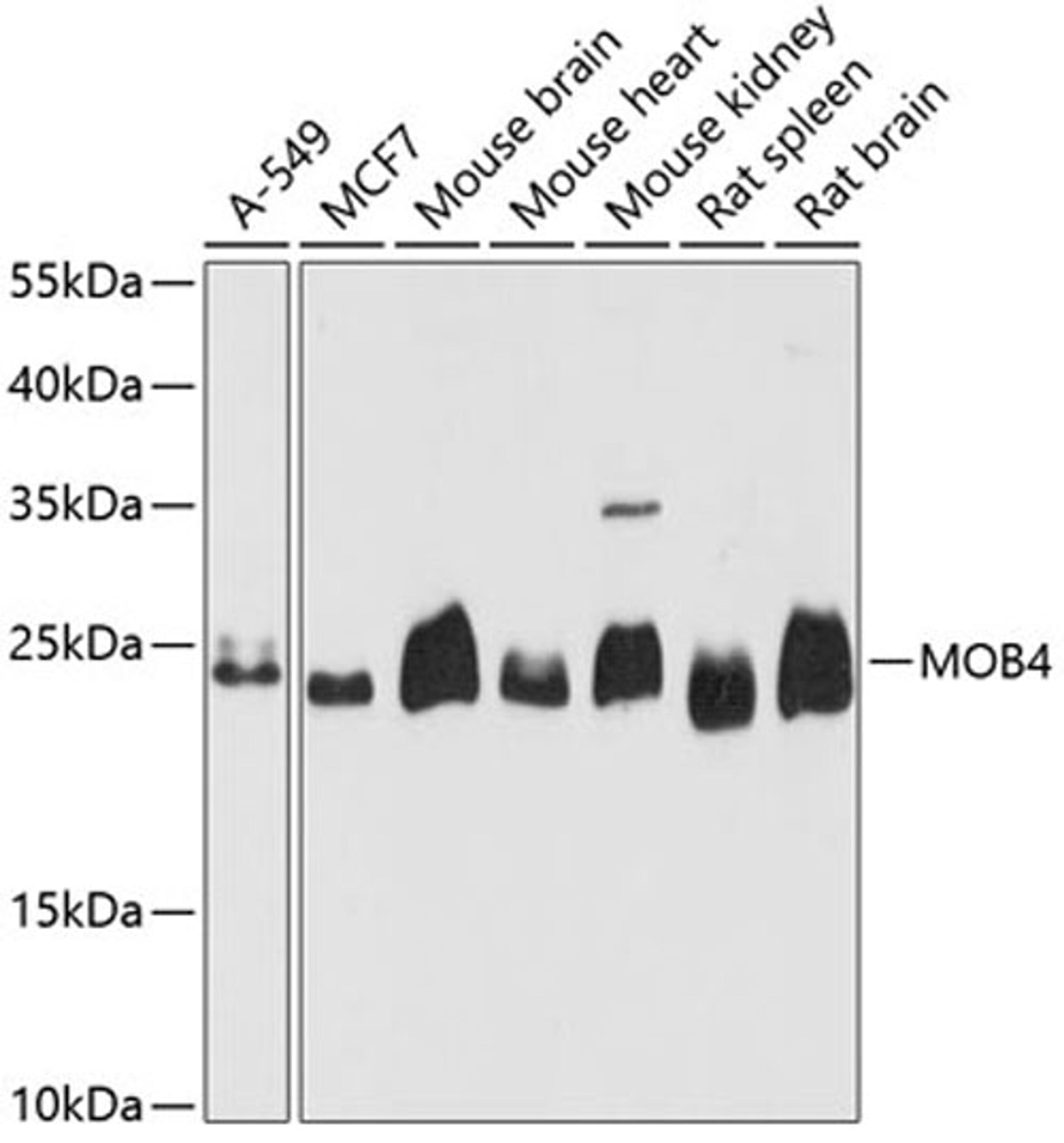 Western blot - MOB4 antibody (A4590)