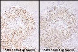 Detection of human SRF by immunohistochemistry.