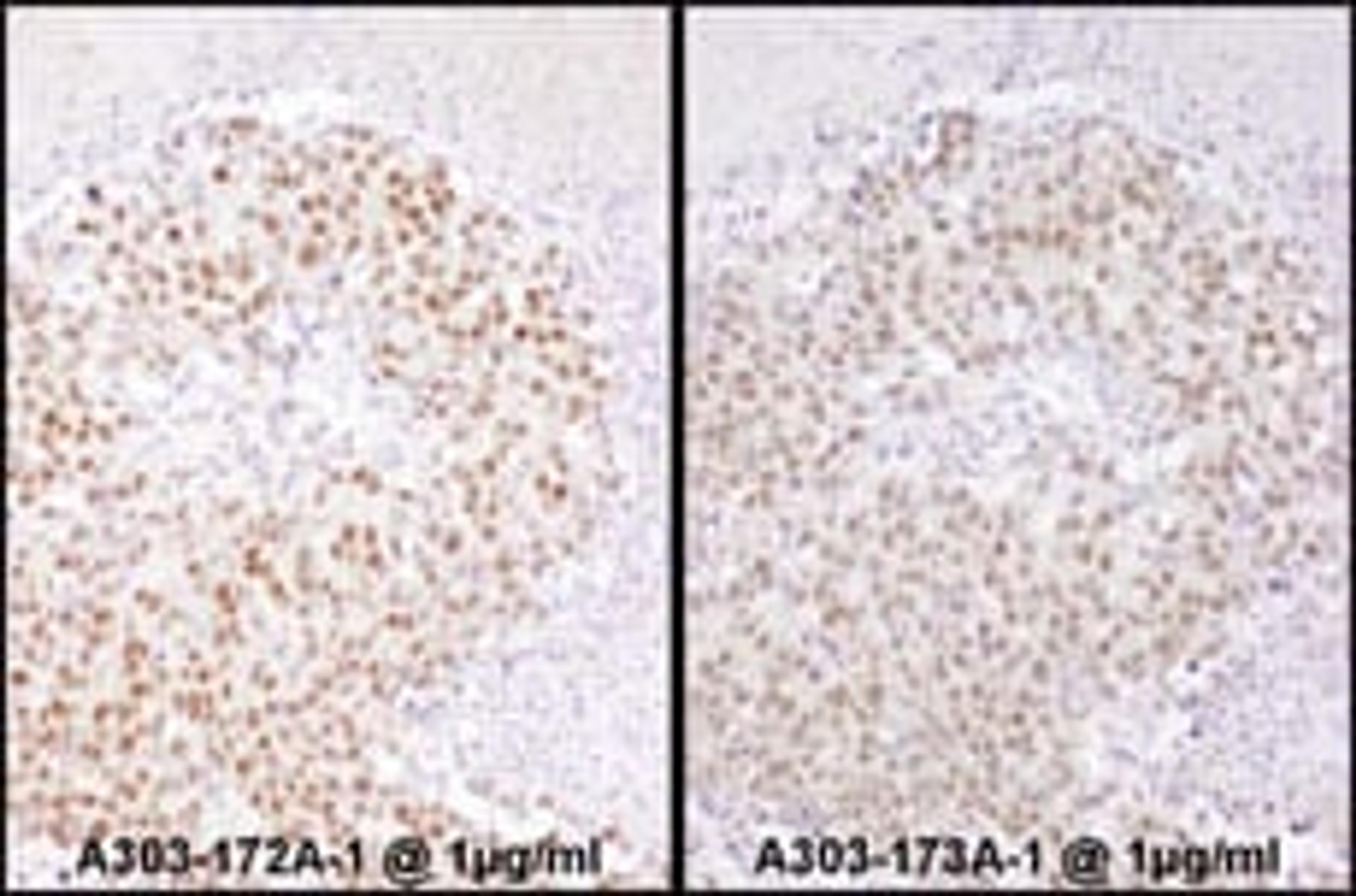 Detection of human SRF by immunohistochemistry.