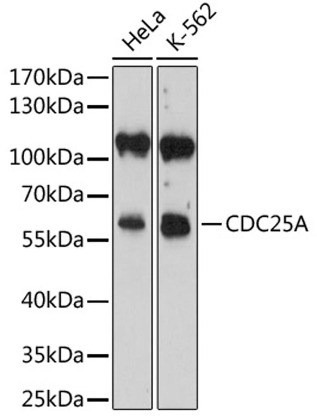 Western blot - CDC25A antibody (A1173)