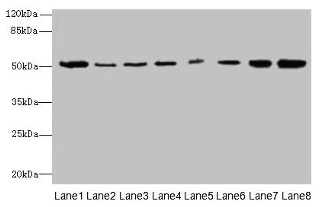 Western blot. All lanes: PGS1 antibody at 2µg/ml. Lane 1: Mouse liver tissue. Lane 2: Hela whole cell lysate. Lane 3: Jurkat whole cell lysate. Lane 4: HepG2 whole cell lysate. Lane 5: THP-1 whole cell lysate. Lane 6: Mouse spleen tissue. Lane 7: Mouse thymus tissue. Lane 8: Mouse kidney tissue. Secondary. Goat polyclonal to rabbit IgG at 1/10000 dilution. Predicted band size: 63, 52, 38, 6 kDa. Observed band size: 52 kDa