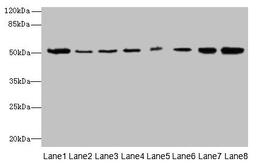 Western blot. All lanes: PGS1 antibody at 2µg/ml. Lane 1: Mouse liver tissue. Lane 2: Hela whole cell lysate. Lane 3: Jurkat whole cell lysate. Lane 4: HepG2 whole cell lysate. Lane 5: THP-1 whole cell lysate. Lane 6: Mouse spleen tissue. Lane 7: Mouse thymus tissue. Lane 8: Mouse kidney tissue. Secondary. Goat polyclonal to rabbit IgG at 1/10000 dilution. Predicted band size: 63, 52, 38, 6 kDa. Observed band size: 52 kDa