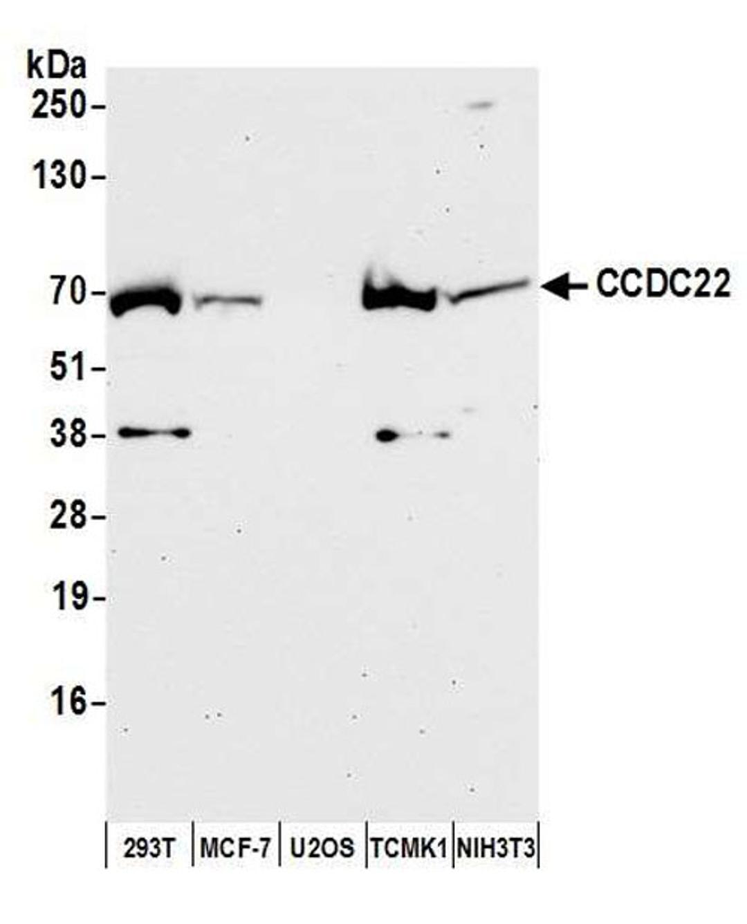 Detection of human and mouse CCDC22 by WB.