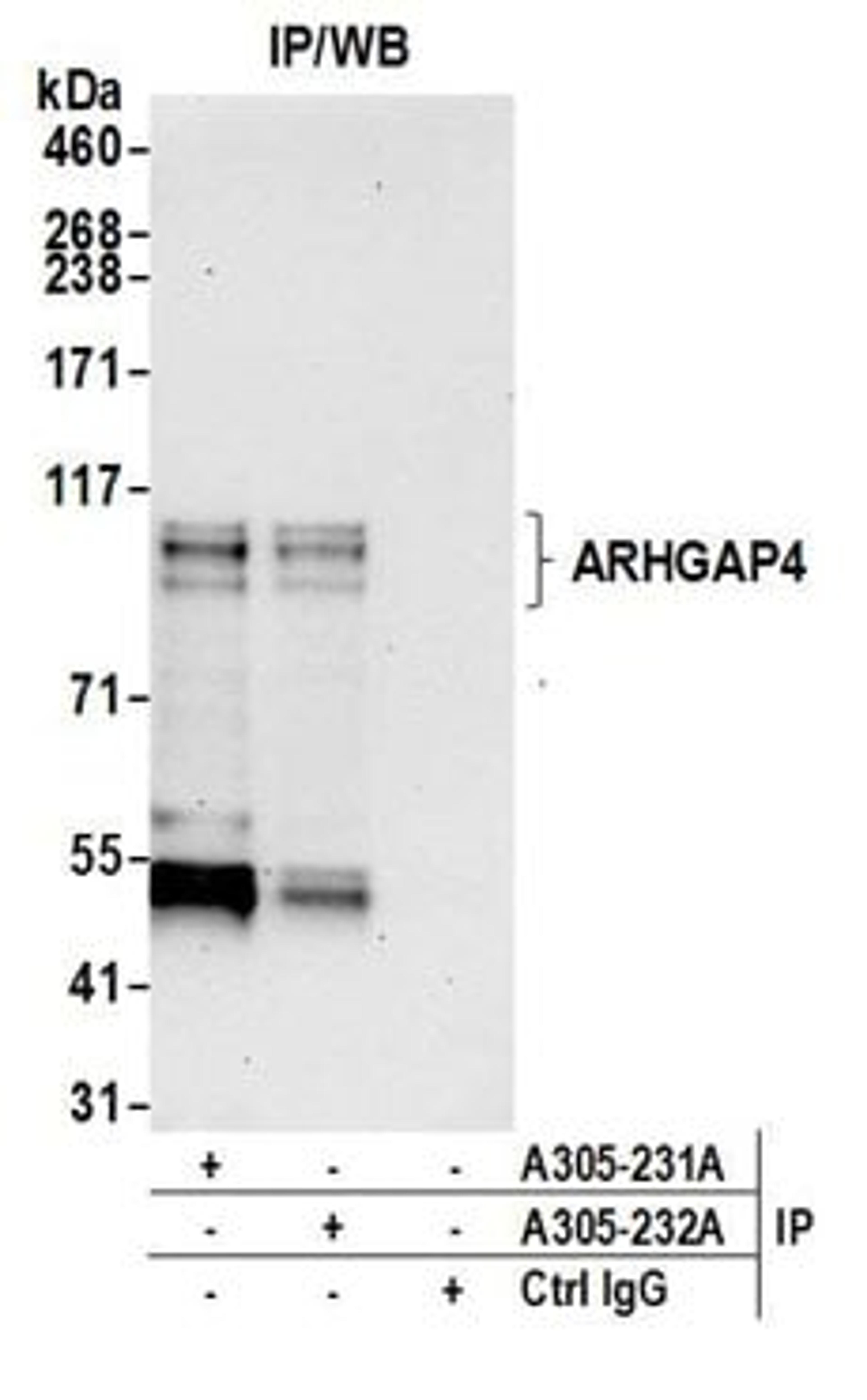 Detection of human ARHGAP4 by western blot of immunoprecipitates.