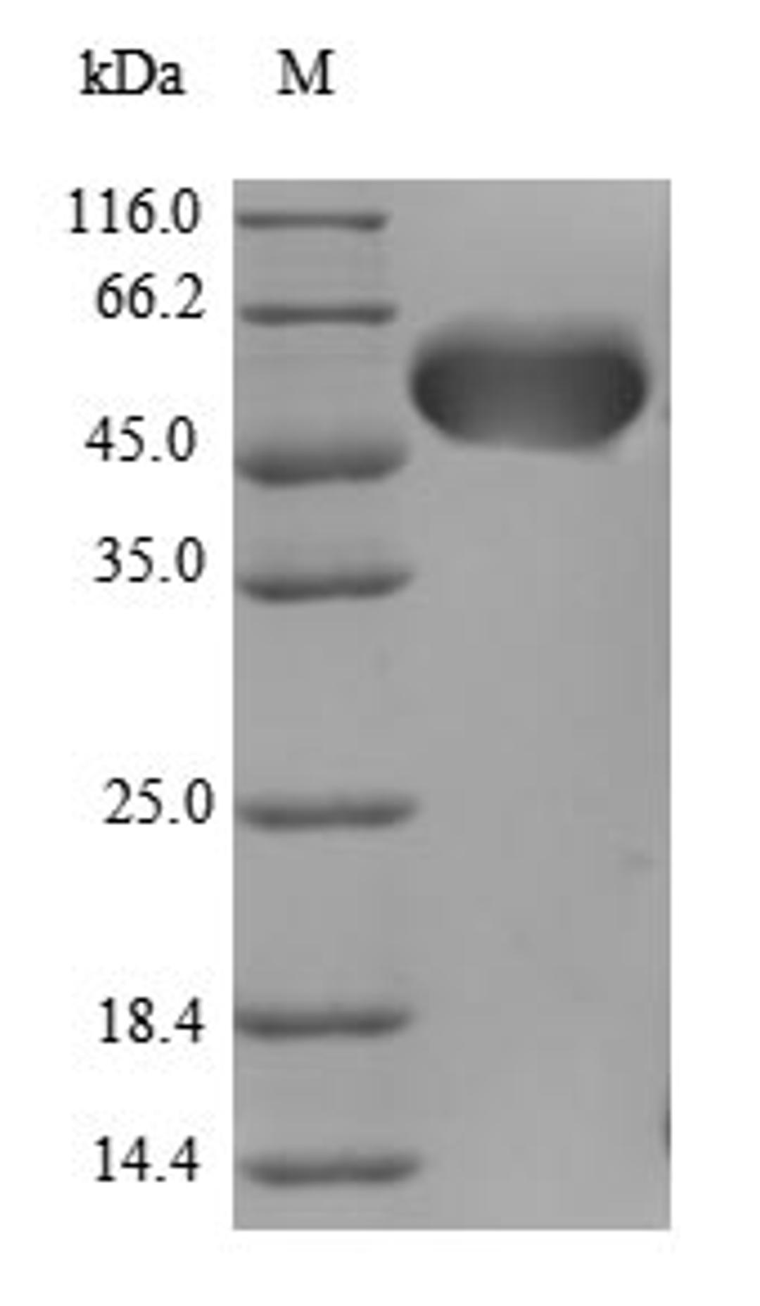 (Tris-Glycine gel) Discontinuous SDS-PAGE (reduced) with 5% enrichment gel and 15% separation gel.