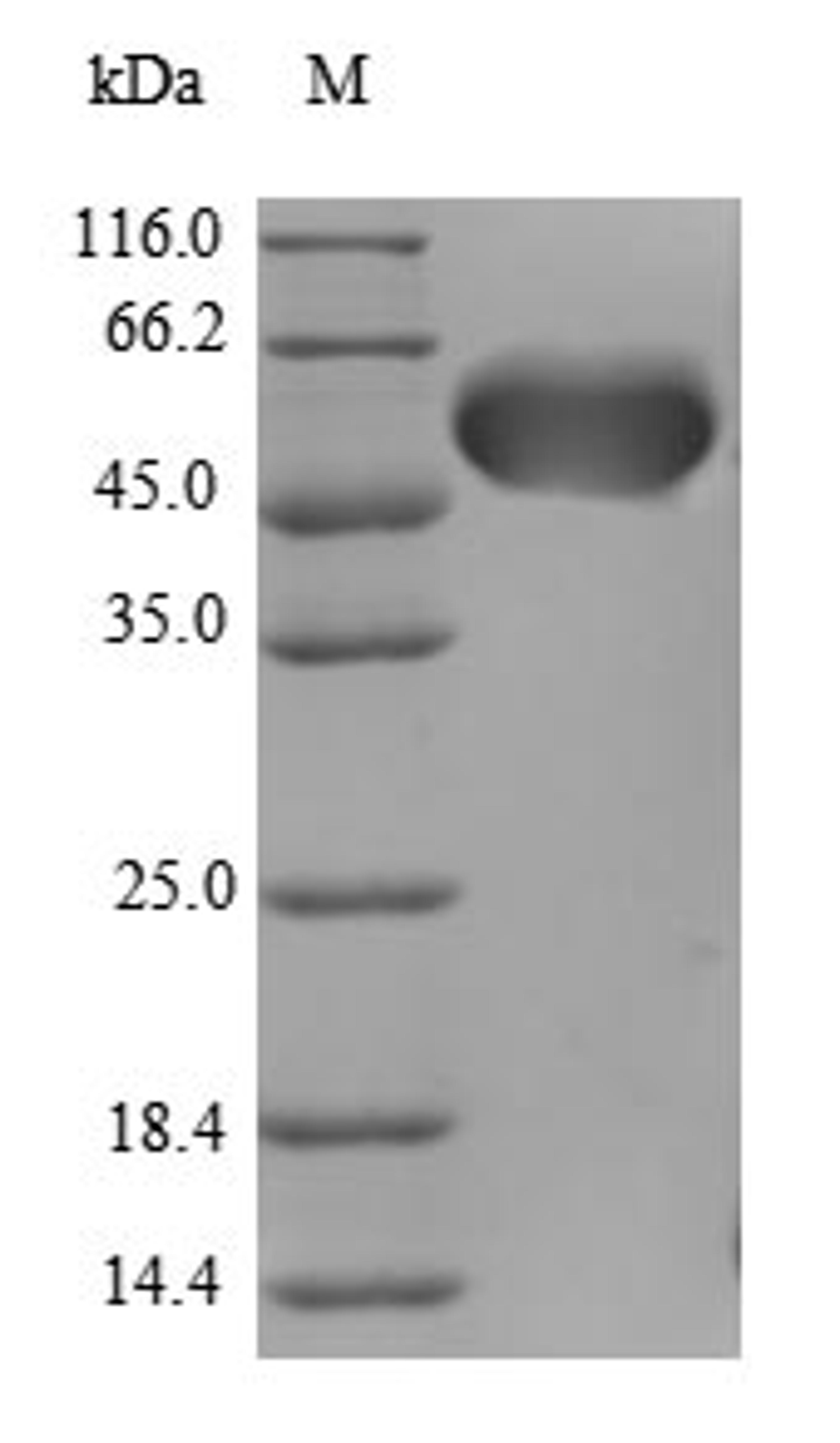 (Tris-Glycine gel) Discontinuous SDS-PAGE (reduced) with 5% enrichment gel and 15% separation gel.