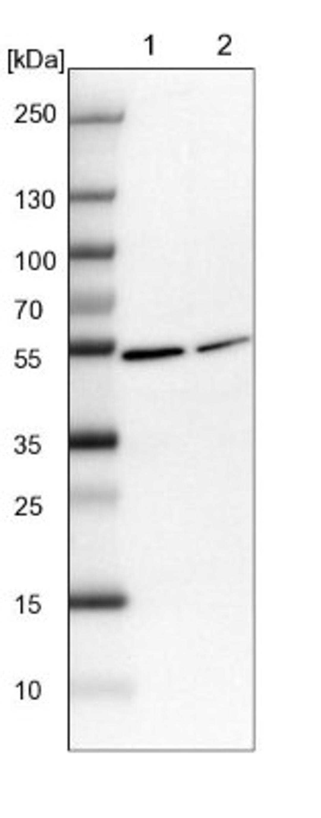 Western Blot: SLC35F4 Antibody [NBP1-94126] - Lane 1: NIH-3T3 cell lysate (Mouse embryonic fibroblast cells)<br/>Lane 2: NBT-II cell lysate (Rat Wistar bladder tumour cells)