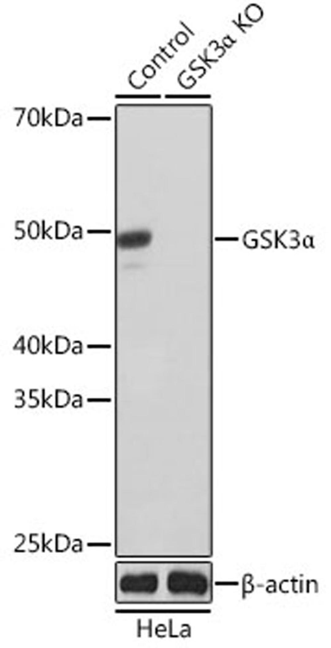 Western blot - GSK3a antibody (A19060)