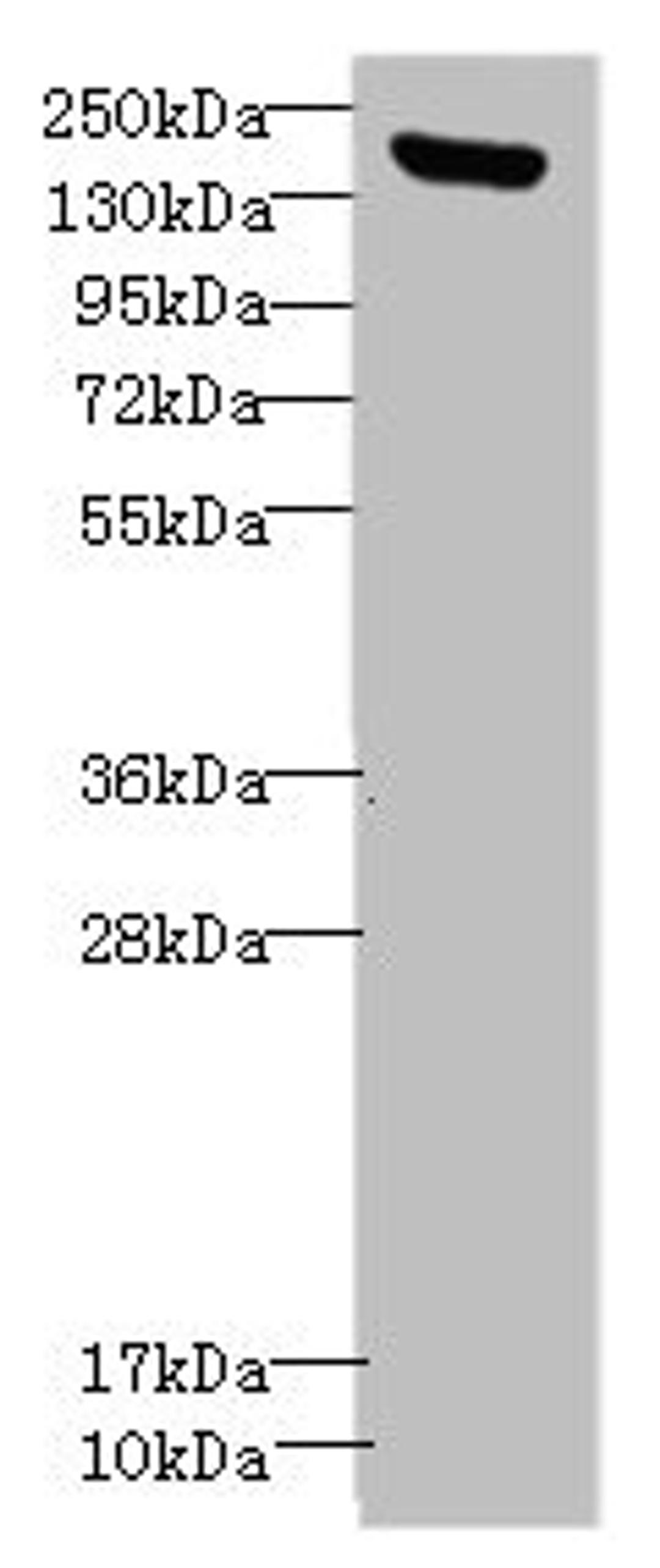 Western blot. All lanes: CNTNAP1antibody IgG at 1.36ug/ml + Mouse brain tissue. Secondary. Goat polyclonal to rabbit IgG at 1/10000 dilution. Predicted band size: 156 kDa. Observed band size: 156 kDa.