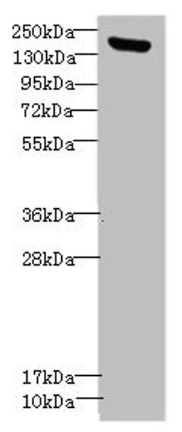 Western blot. All lanes: CNTNAP1antibody IgG at 1.36ug/ml + Mouse brain tissue. Secondary. Goat polyclonal to rabbit IgG at 1/10000 dilution. Predicted band size: 156 kDa. Observed band size: 156 kDa.