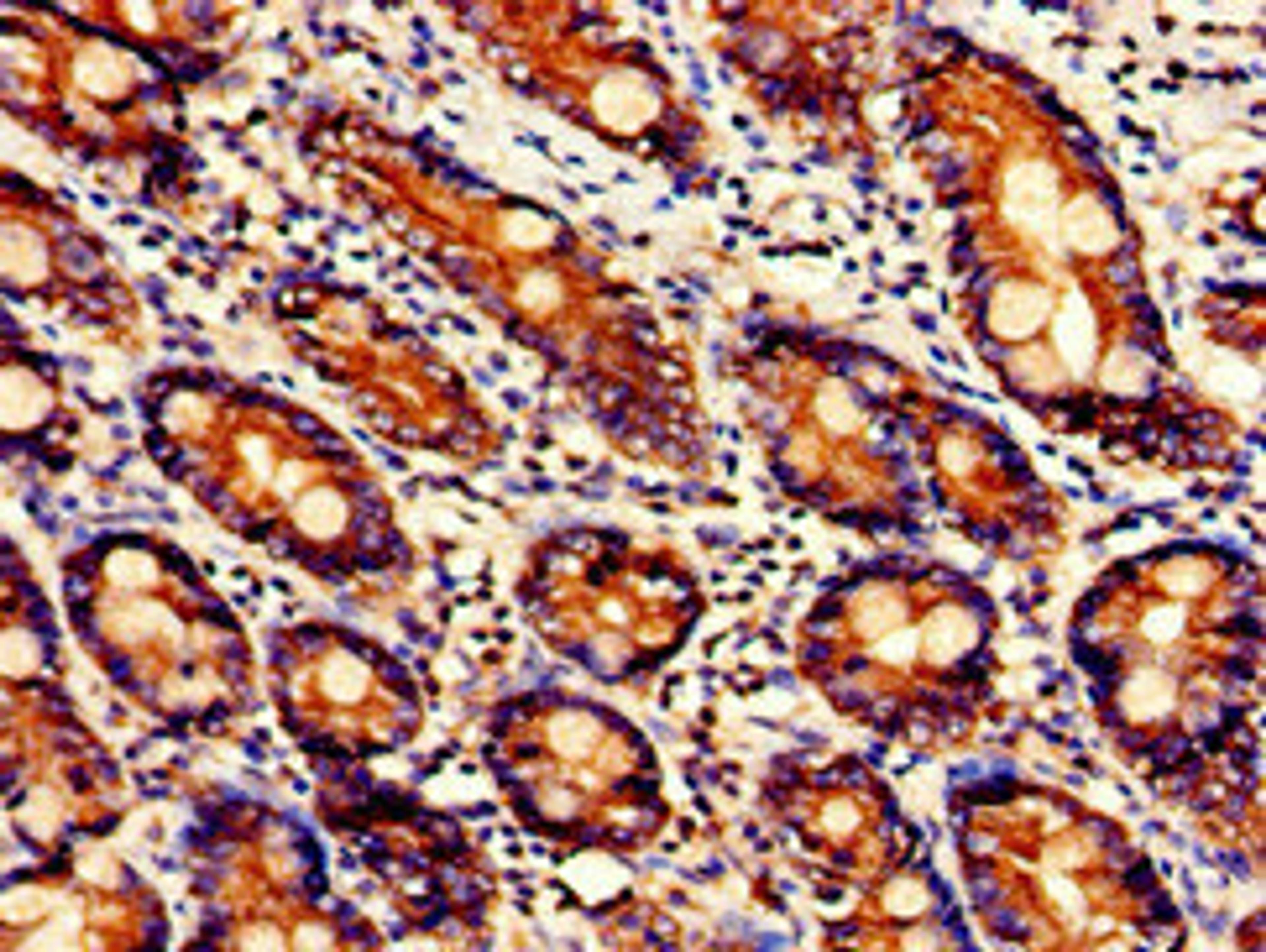 Immunohistochemistry of paraffin-embedded human small intestine tissue using CSB-PA025582LA01HU at dilution of 1:100