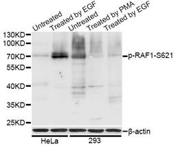 Western blot - Phospho-Raf1-S621 antibody (AP0087)