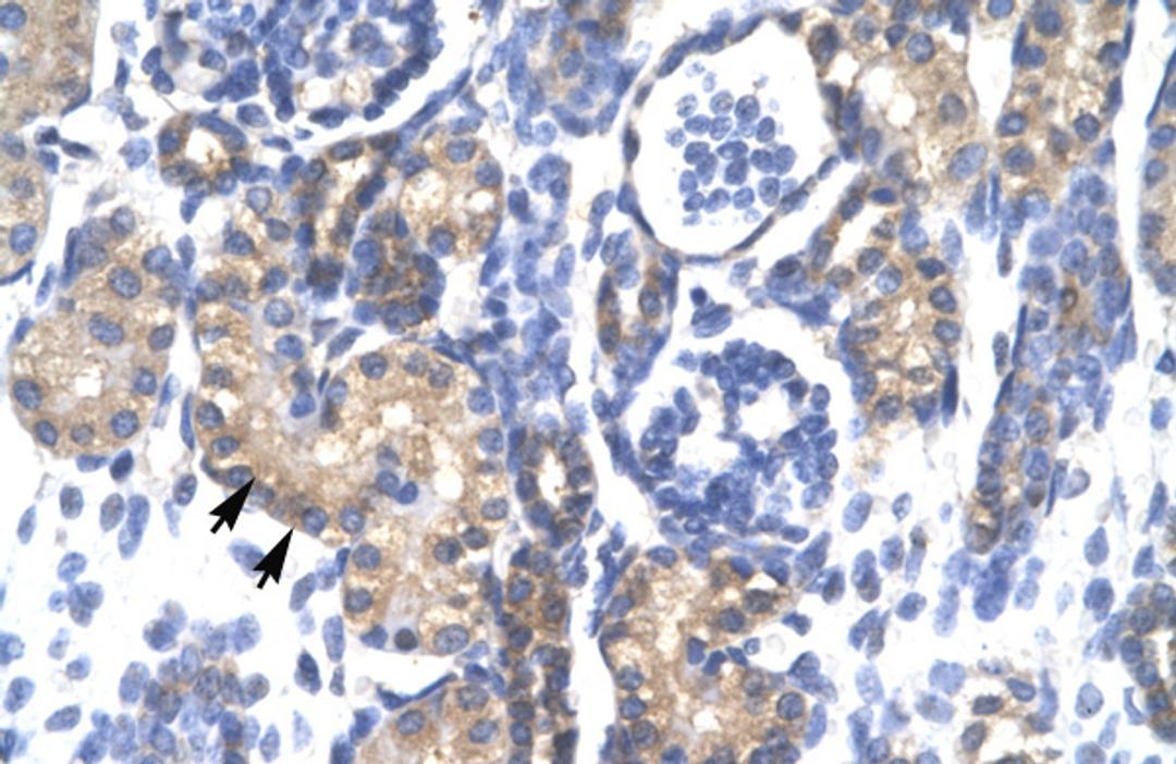 Antibody used in IHC on Human kidney.