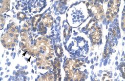 Antibody used in IHC on Human kidney.