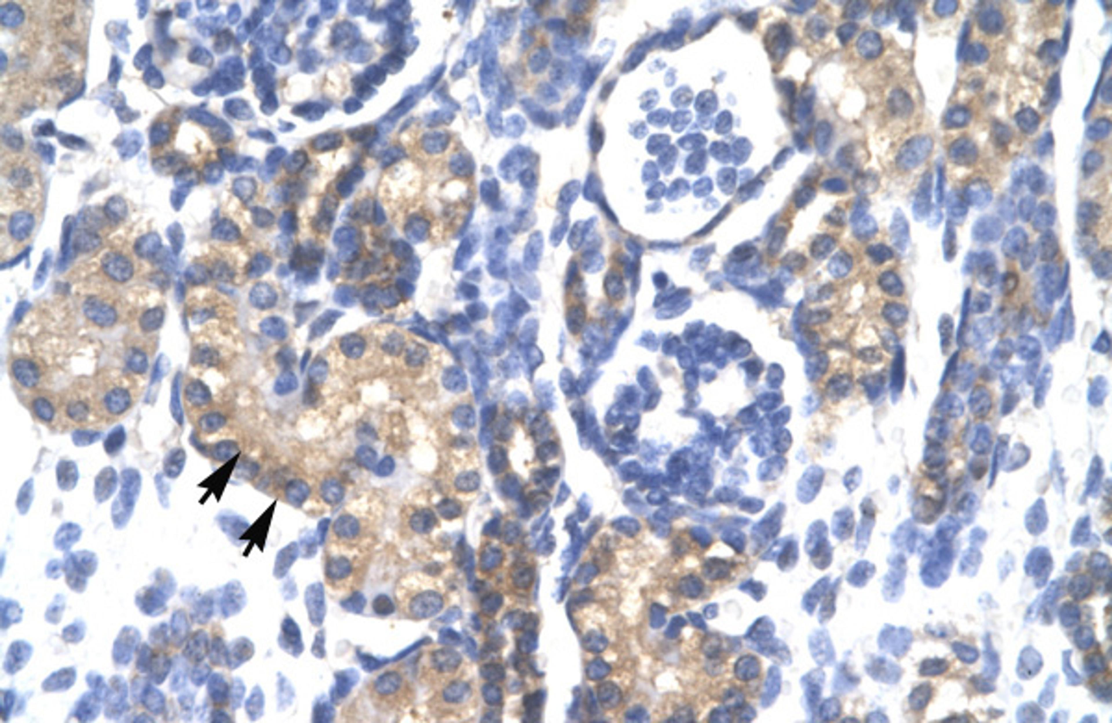 Antibody used in IHC on Human kidney.