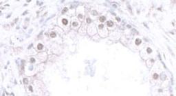 Detection of human CBX6 by immunohistochemistry.