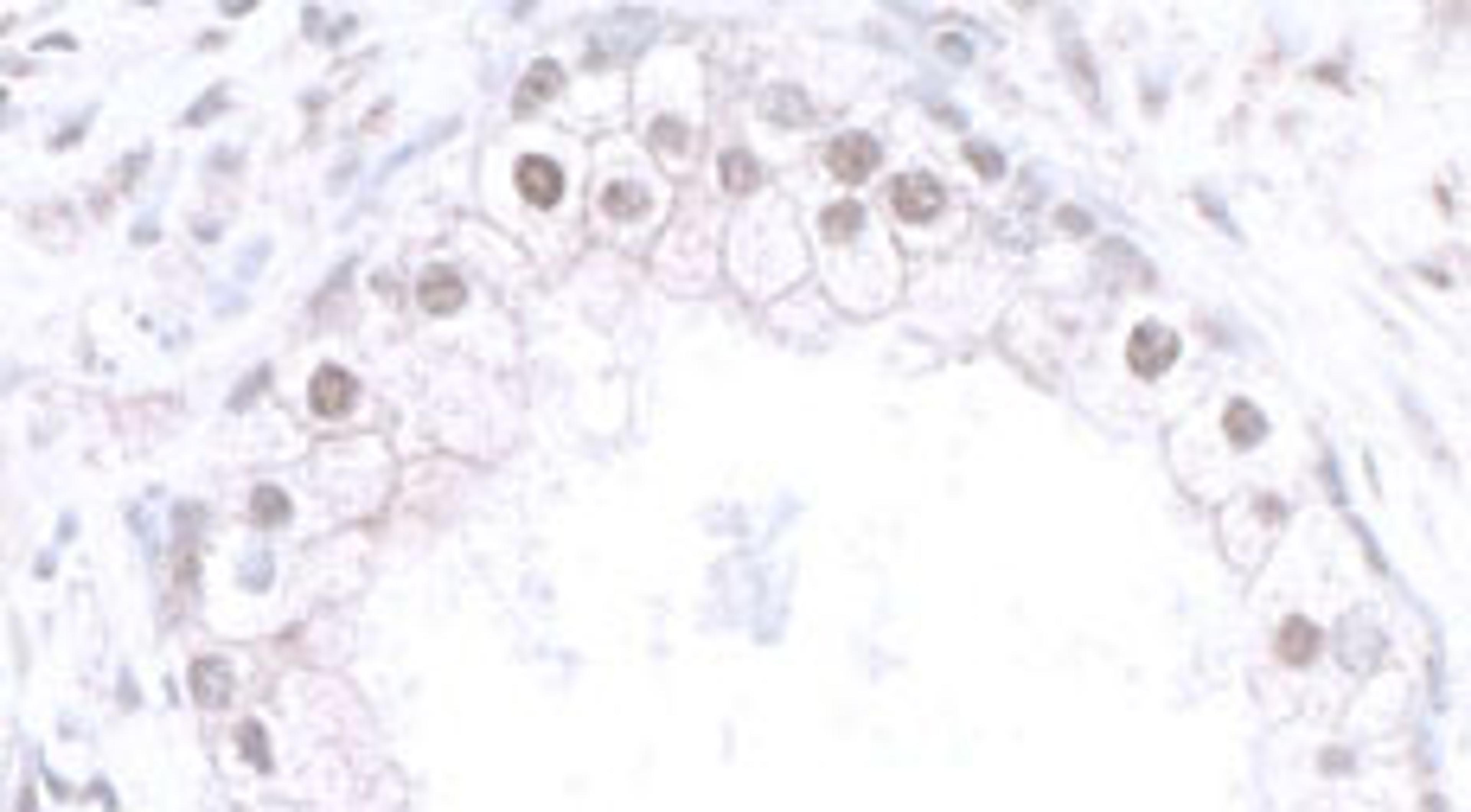 Detection of human CBX6 by immunohistochemistry.