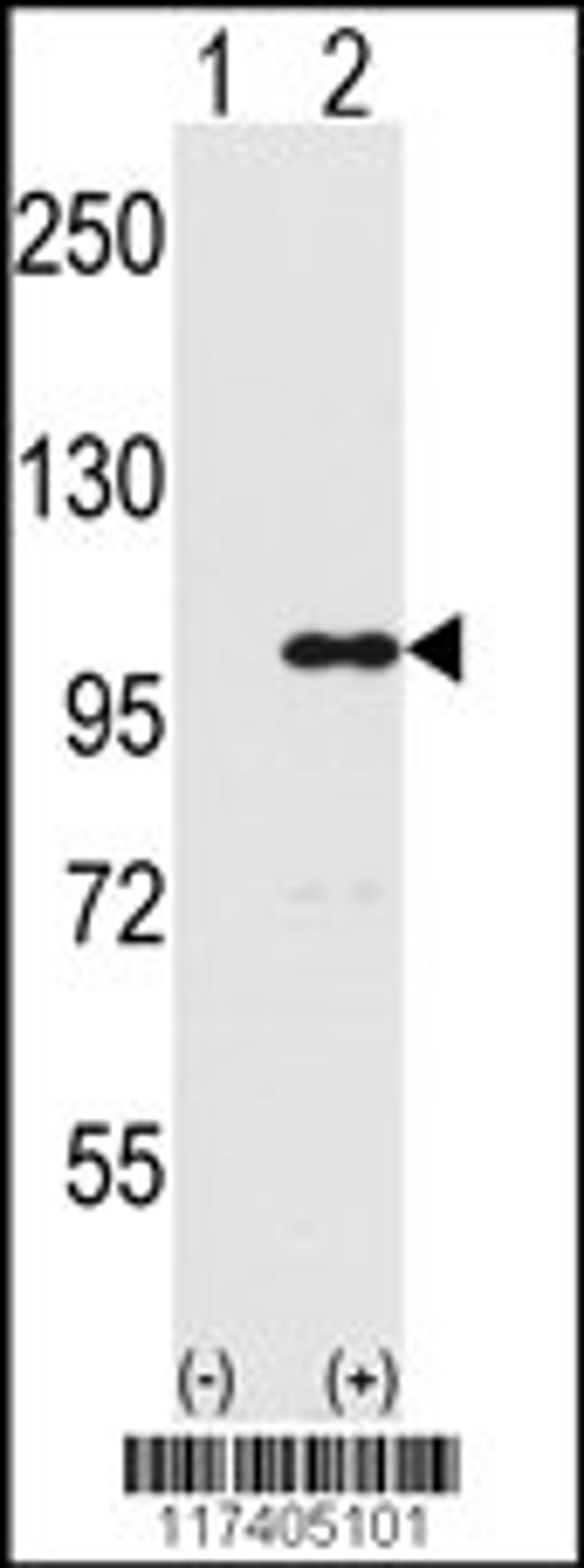 Western blot analysis of INPP5D using rabbit polyclonal INPP5D Antibody using 293 cell lysates (2 ug/lane) either nontransfected (Lane 1) or transiently transfected with the INPP5D gene (Lane 2).