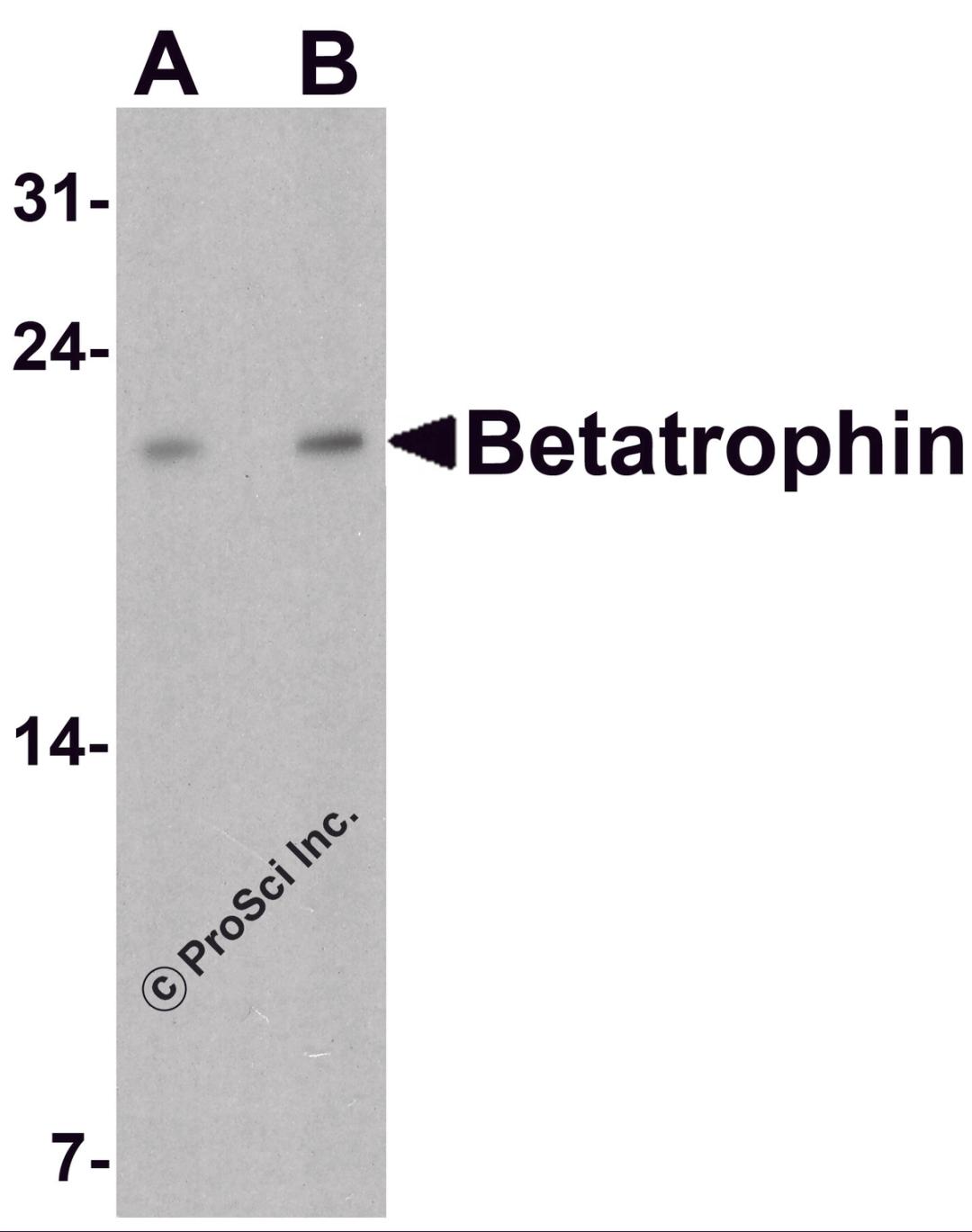 Western blot analysis of Betatrophin in rat liver tissue lysate with Betatrophin antibody at (A) 1 and (B) 2 μg/ml.
