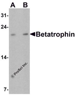Western blot analysis of Betatrophin in rat liver tissue lysate with Betatrophin antibody at (A) 1 and (B) 2 μg/ml.