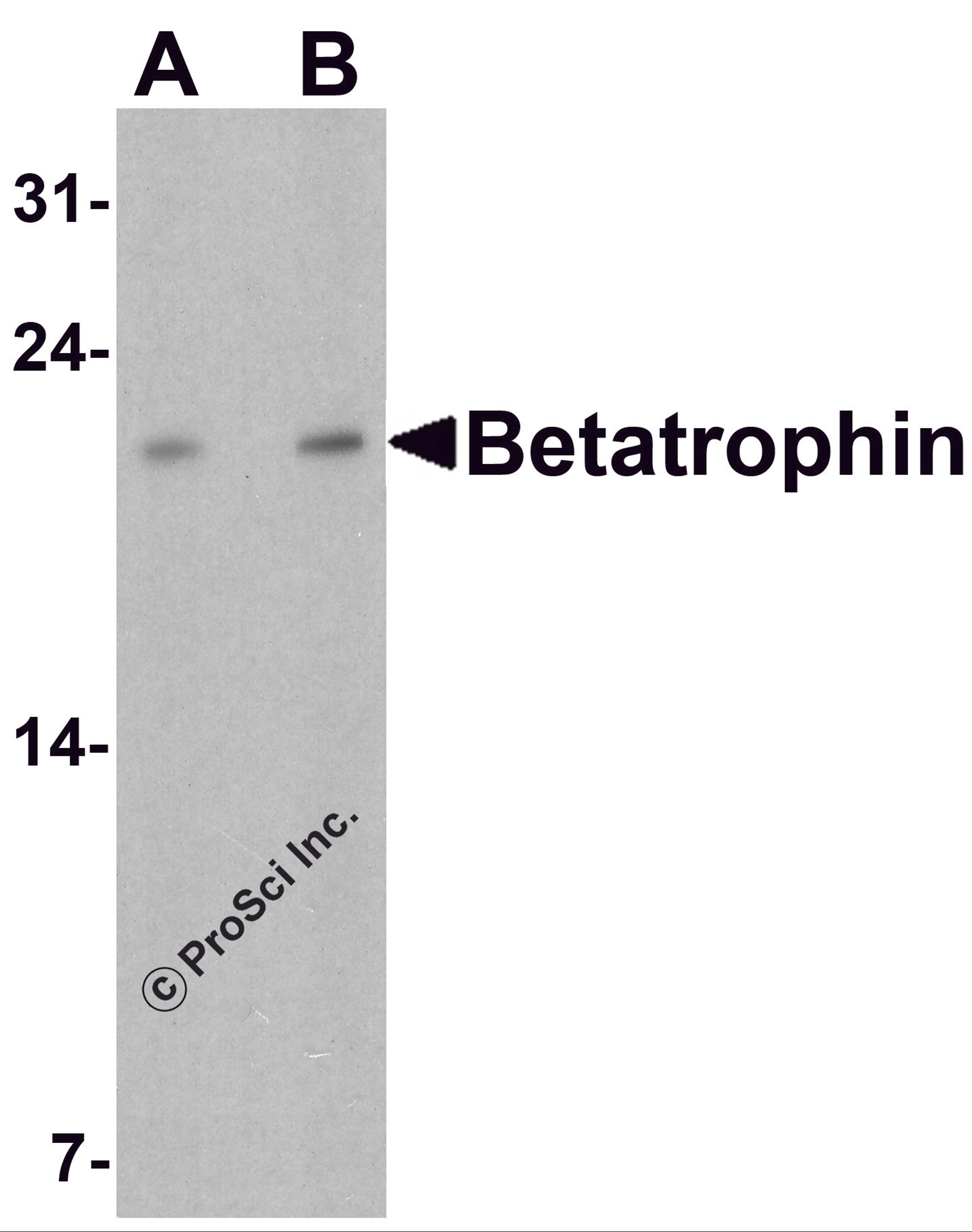 Western blot analysis of Betatrophin in rat liver tissue lysate with Betatrophin antibody at (A) 1 and (B) 2 μg/ml.